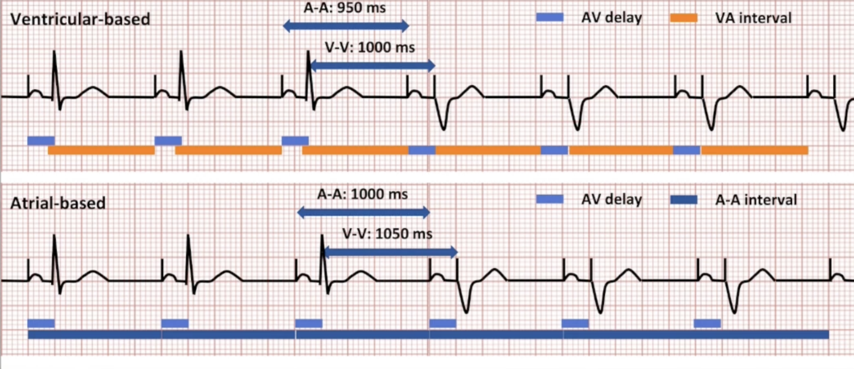 <p>Ventricle-based vs Atrial-based AP/VS to AP/VP diagram</p>
