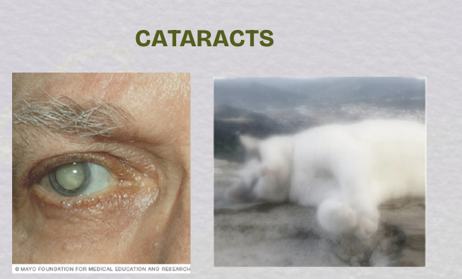 <p>cloudy or dirty vision</p>