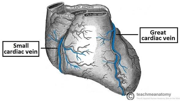 <p>st</p><p>left posterior flap</p><p>follow coronary sinus to opposite end</p><p>H2</p><p>19</p>