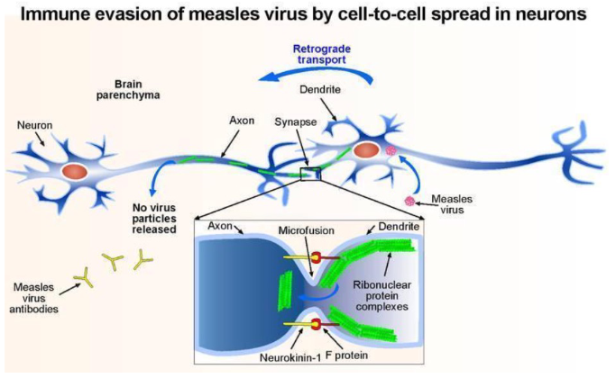 <p>- immune evasion of measles virus by cell-to-cell spread in neurons</p><p>.</p><p>- basically the virus stays latent and then all of a sudden it becomes reactive</p>