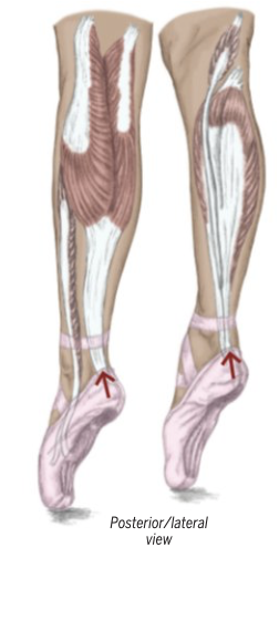 <p>Plantar Flexion </p>