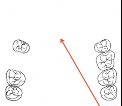 <p>What kennedy classification?</p>