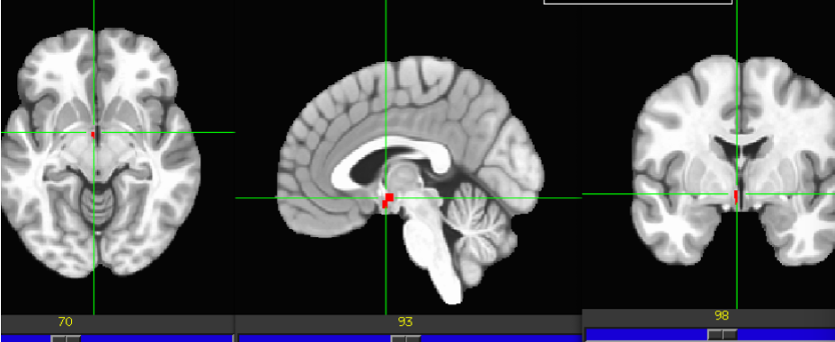 term image