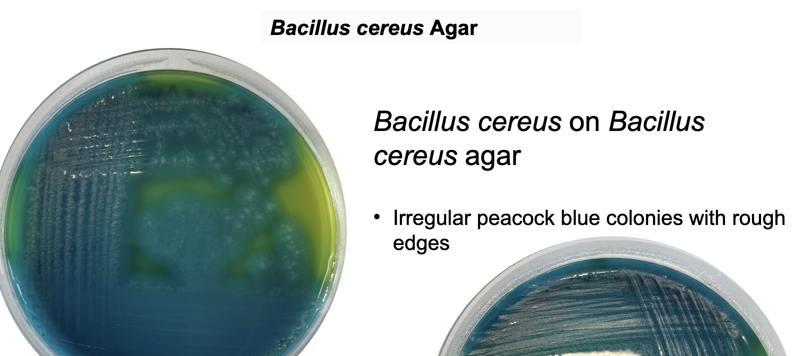 <p>Selective + differential medium detecting <strong>mannitol fermentation and lecithinase activity</strong>.</p><p>Inhibits most bacteria except Bacillus spp.</p>