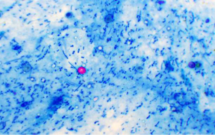 <p><span>4&nbsp;<strong>µm </strong>Modified Acid Fast Stain</span></p>