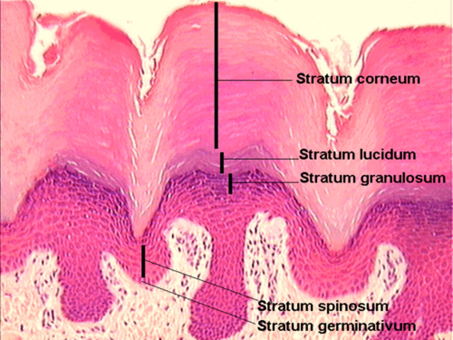 <p>Clear layer only in thick skin</p>