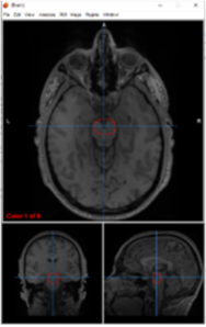 <p>VTA (ventral tegmental area)</p>