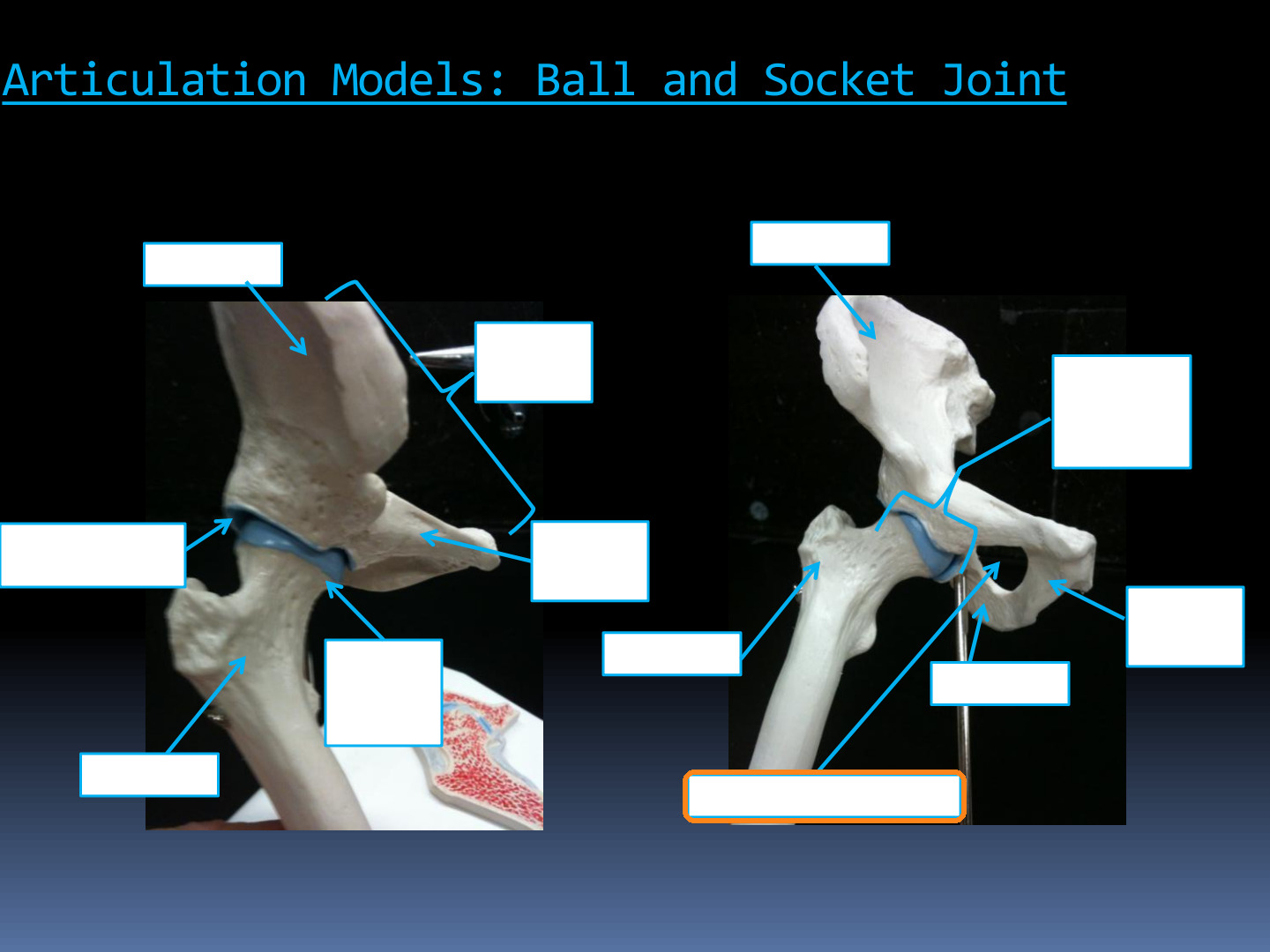 <p>Identify the highlighted structure in the Hip Articulation Models diagram.</p>