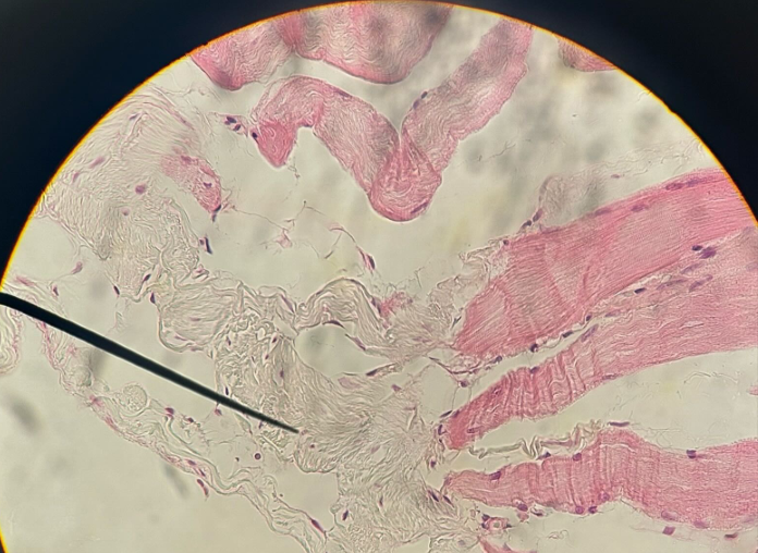 <p>ID tissue</p>