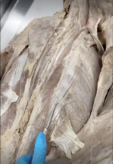 <p>Name the Muscle</p><p>- I Love Science</p><p>- ILS lateral to medial</p><p>- shiny lateral vertical part of back</p>