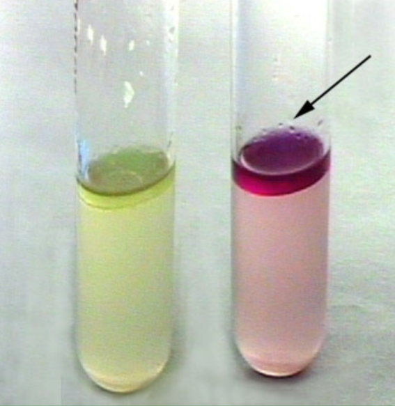 <p>Sulfide <strong><u>Indole </u></strong>Motility tests for?</p>
