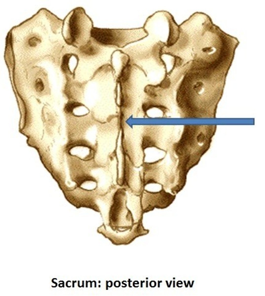 <p>fused spinous processes</p>
