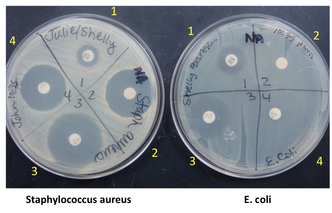 <p>to determine the effectivness of <span>antibiotic on growth we</span>?</p>