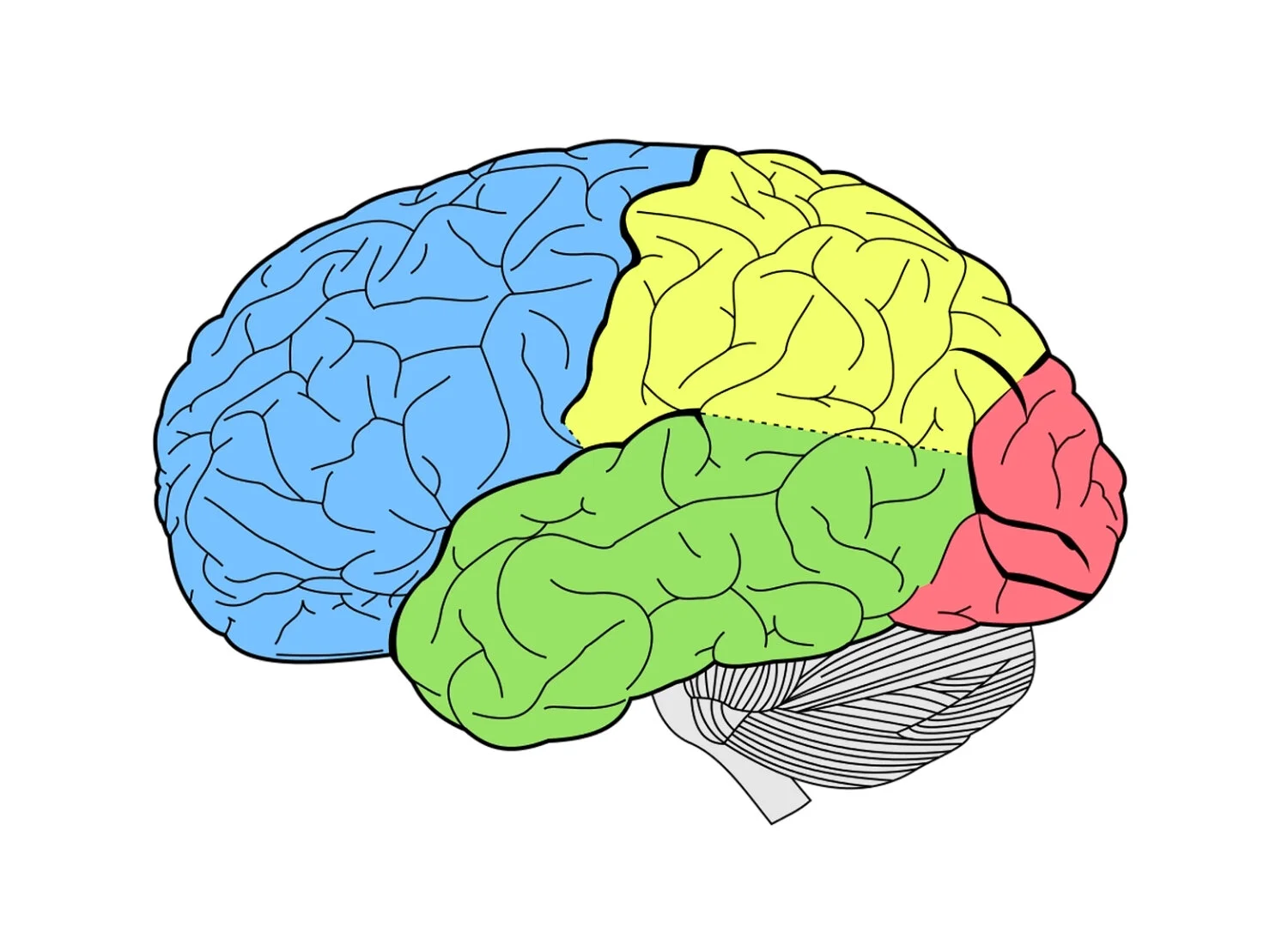 <p>which lobe is highlighted in green?</p><ul><li><p>Parietal</p></li><li><p>Frontal</p></li><li><p>Occipital</p></li><li><p>Temporal</p></li></ul><p></p>
