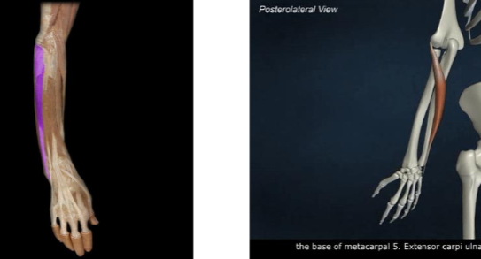 <p>wrist extension and ulnar deviation</p>