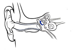 <p>a tiny bone that passes vibrations from the hammer to the stirrup</p>
