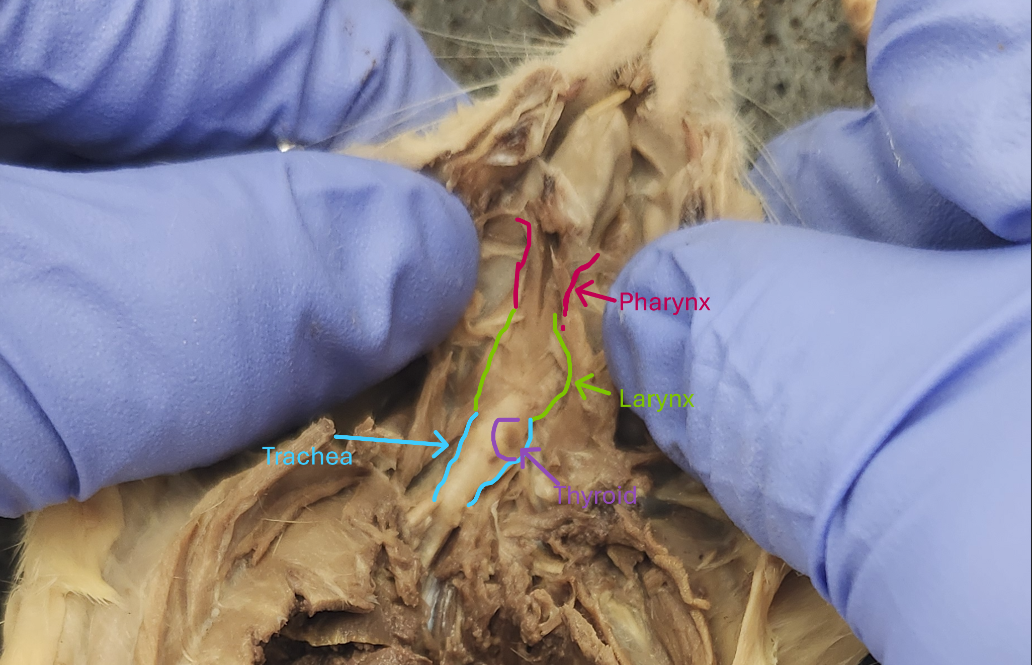 <p><span style="color: rgb(255, 255, 255);">Pharynx, Larynx, Trachea </span></p>