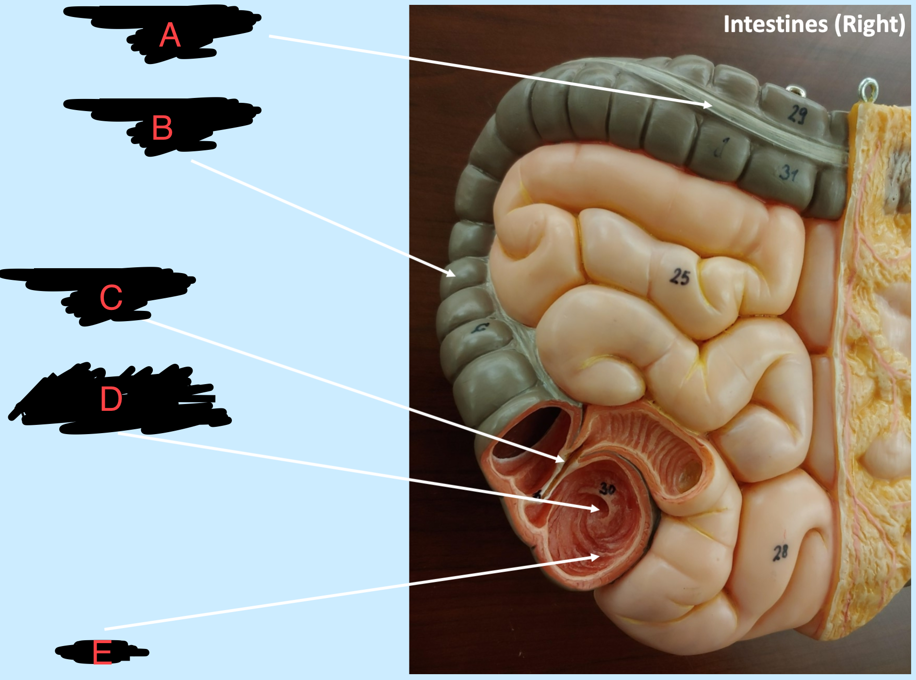 <p>what’s labeled </p>
