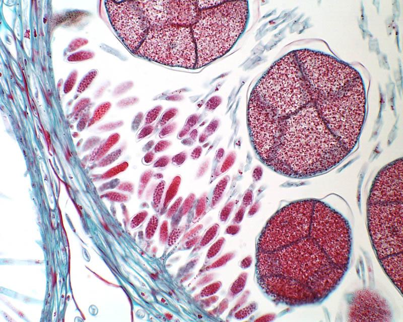 <p>Based on the image, identify whether the Fucus oogonia are mature or immature.</p>