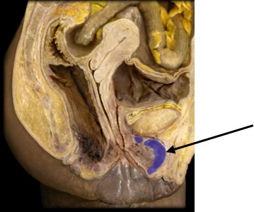 <p>what is the structure highlighted?</p>