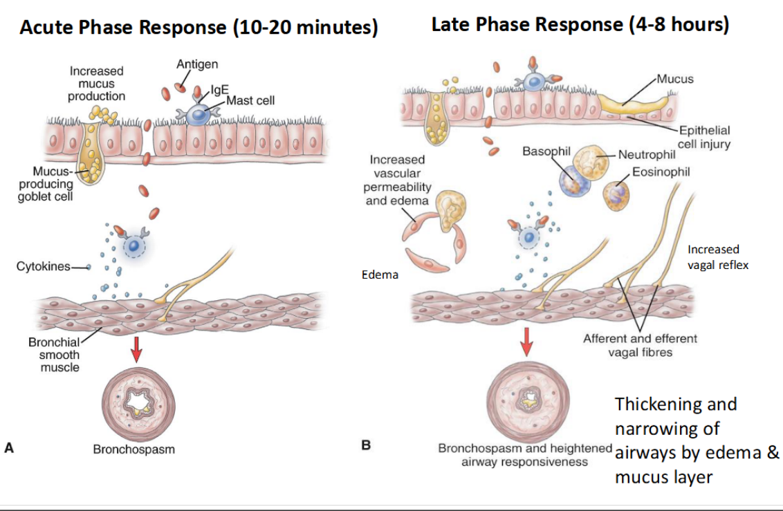 <p>Acute </p><p><span><br>Usual type I hypersensitivity response: allergen<br>exposure to the bronchial mucosa activates B<br>cells (plasma cells) to produce IgE which<br>complexes with mast cells<br>– Further exposure cross-links the IgE, causing the<br>mast cells to release a host of chemicals→<br>causing vasodilation, increased capillary<br>permeability, mucosal edema, bronchial smooth<br>muscle contraction and mucous secretion. (See<br>diagram; also Module 2 )<br>– Clinical manifestations at the beginning of an<br>attack:<br>• chest constriction, expiratory wheezing,<br>dyspnea, tachycardia, coughing</span></p>