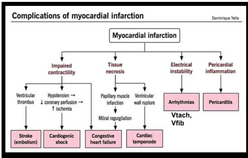 <p>blood flow completely cut off resulting in tissue death</p>