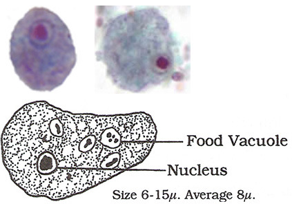 <p>Trophozoite with single nucleus, no chromatin present</p><p>Cyst with 4 nuclei and karyosomes</p><p>NONPATHOGEN</p>
