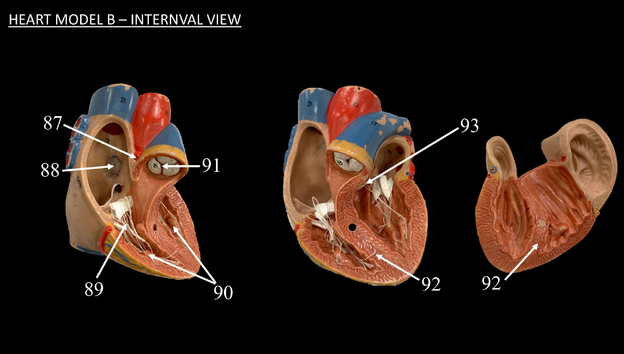 <p>WHAT IS 93 CALLED?</p>