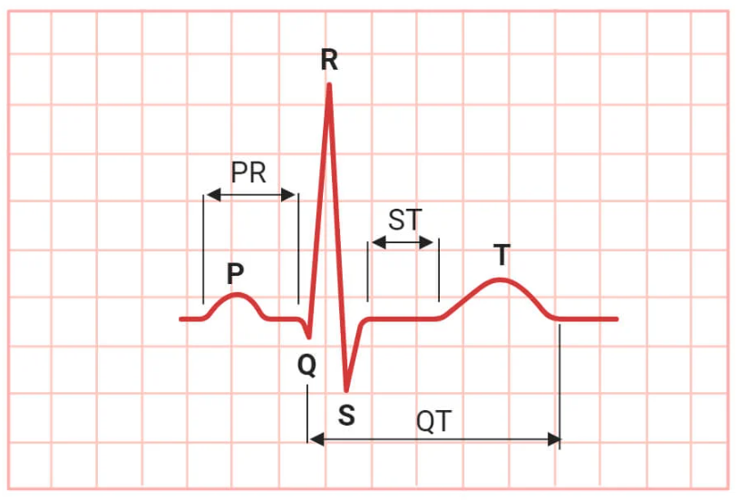 <p>Maps the heart's electrical pathways. </p><ul><li><p>P wave represents atrial depolarization</p></li><li><p>QRS complex represents ventricular depolarization </p></li><li><p>T wave represents ventricular repolarization</p></li></ul><p></p>