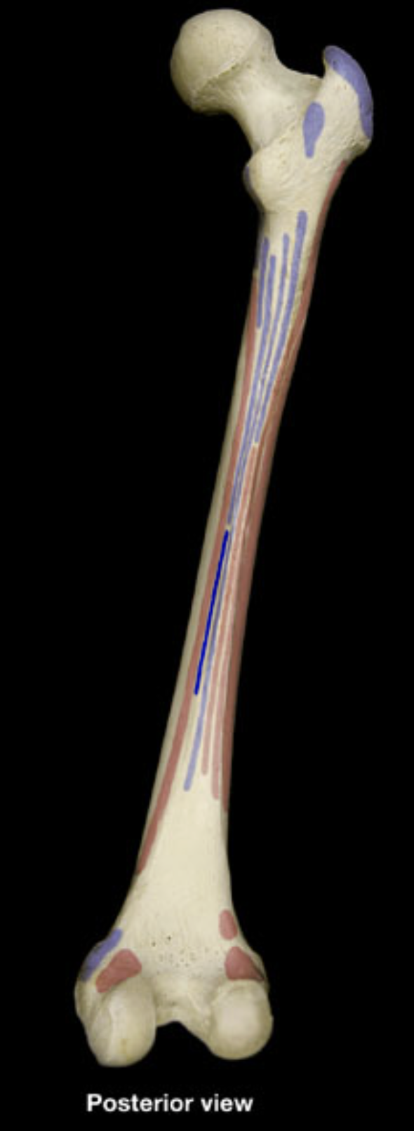 <p>linea aspera of femur</p>