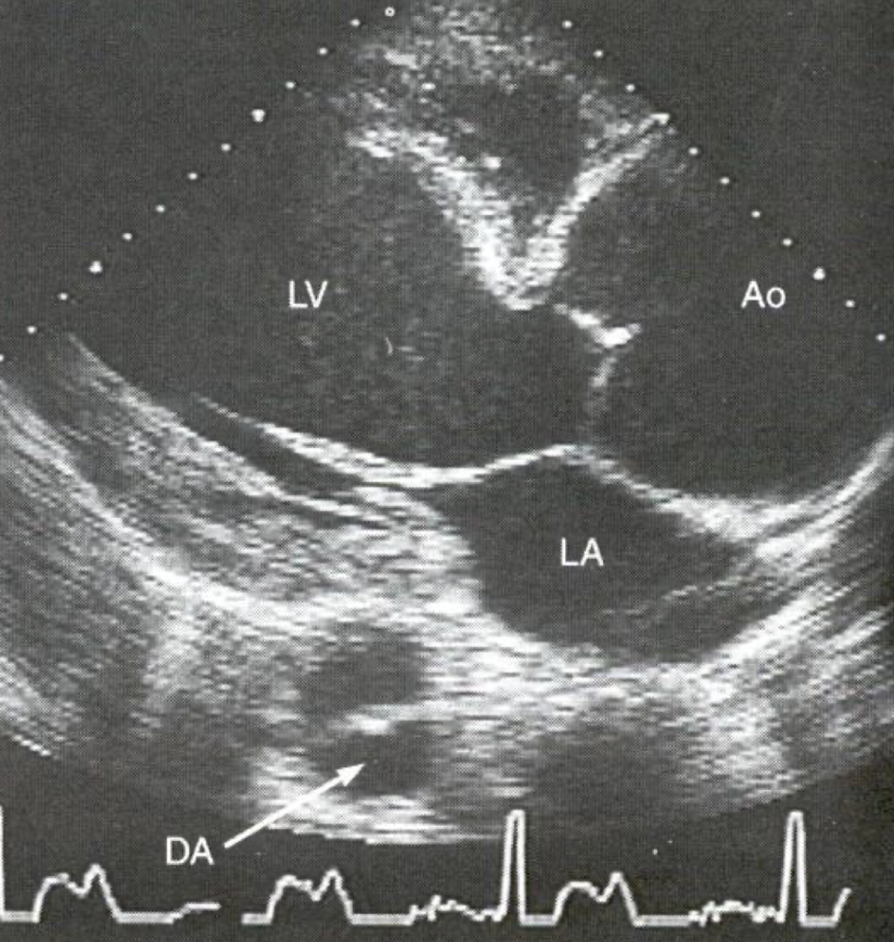 <p>what syndrome</p>