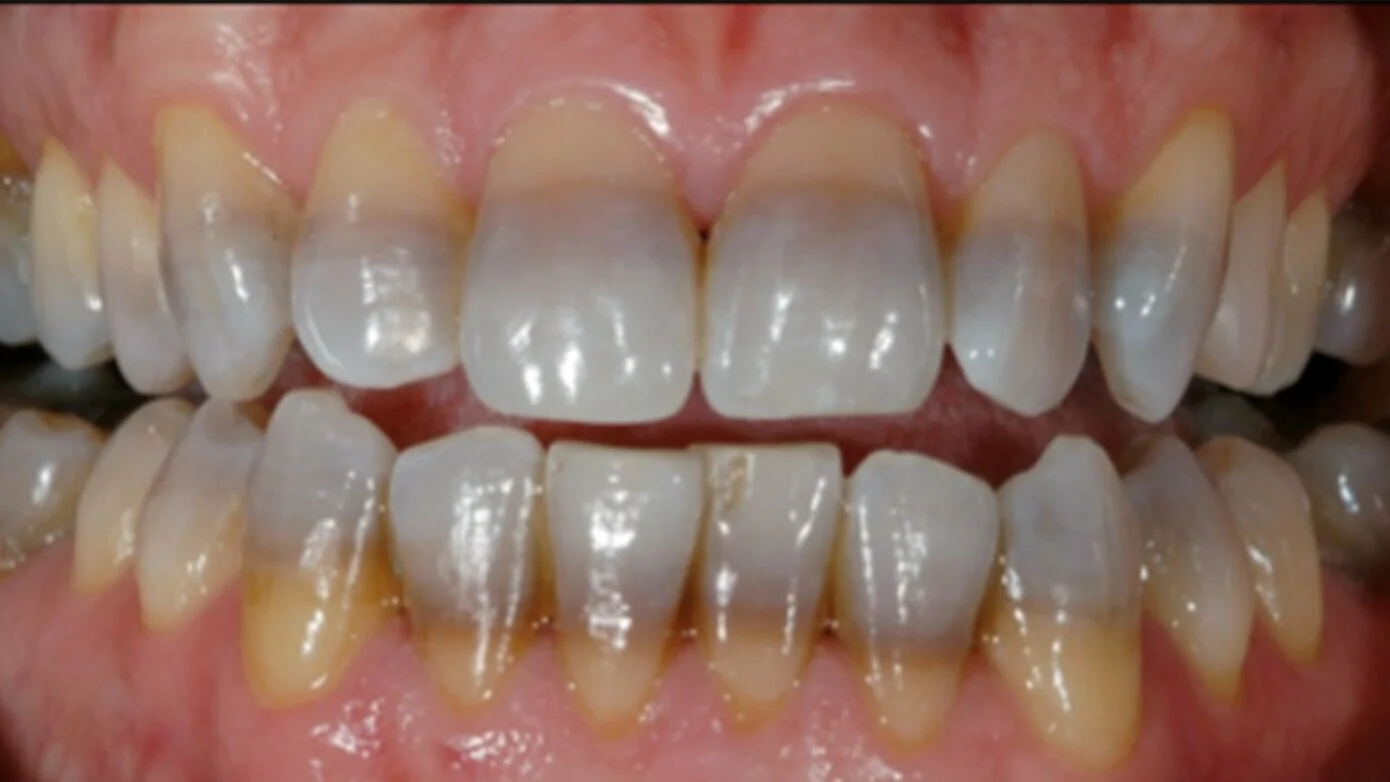 <p>Define intrinsic stains and where it is located</p>