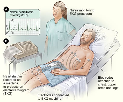 <p>Prior to running an EKG tracing, which of the following is the <mark data-color="yellow" style="background-color: yellow; color: inherit;">final step a medical assistant should take to ensure the tracing will be clear</mark> with a horizontal baseline? </p><p>A. Remove artifacts </p><p>B. Enter patient information into the EKG </p><p>C. Cover the patient with a blanket </p><p>D. Double check the electrodes' attachment</p>