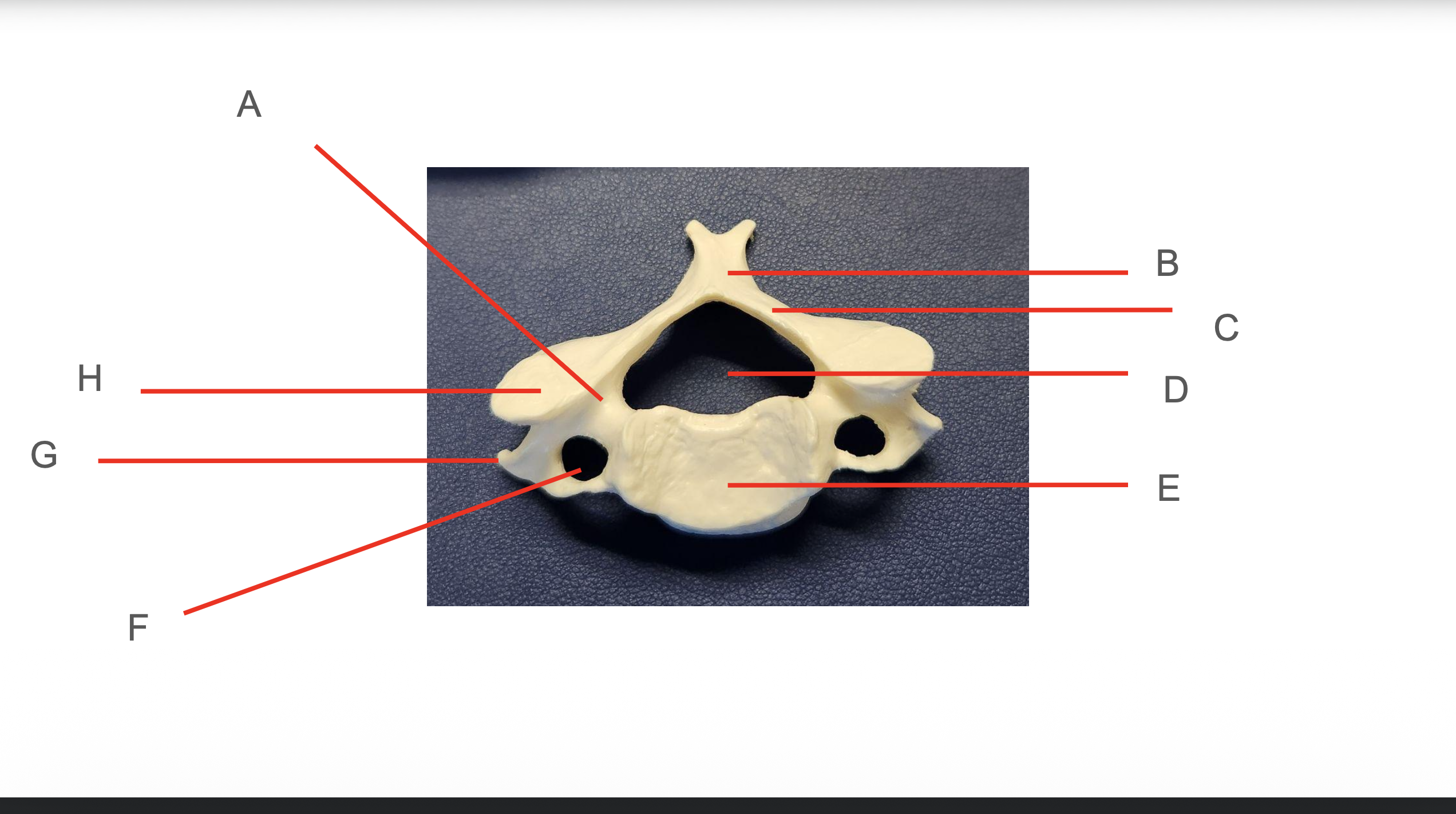 <p>Identify Structure B</p>