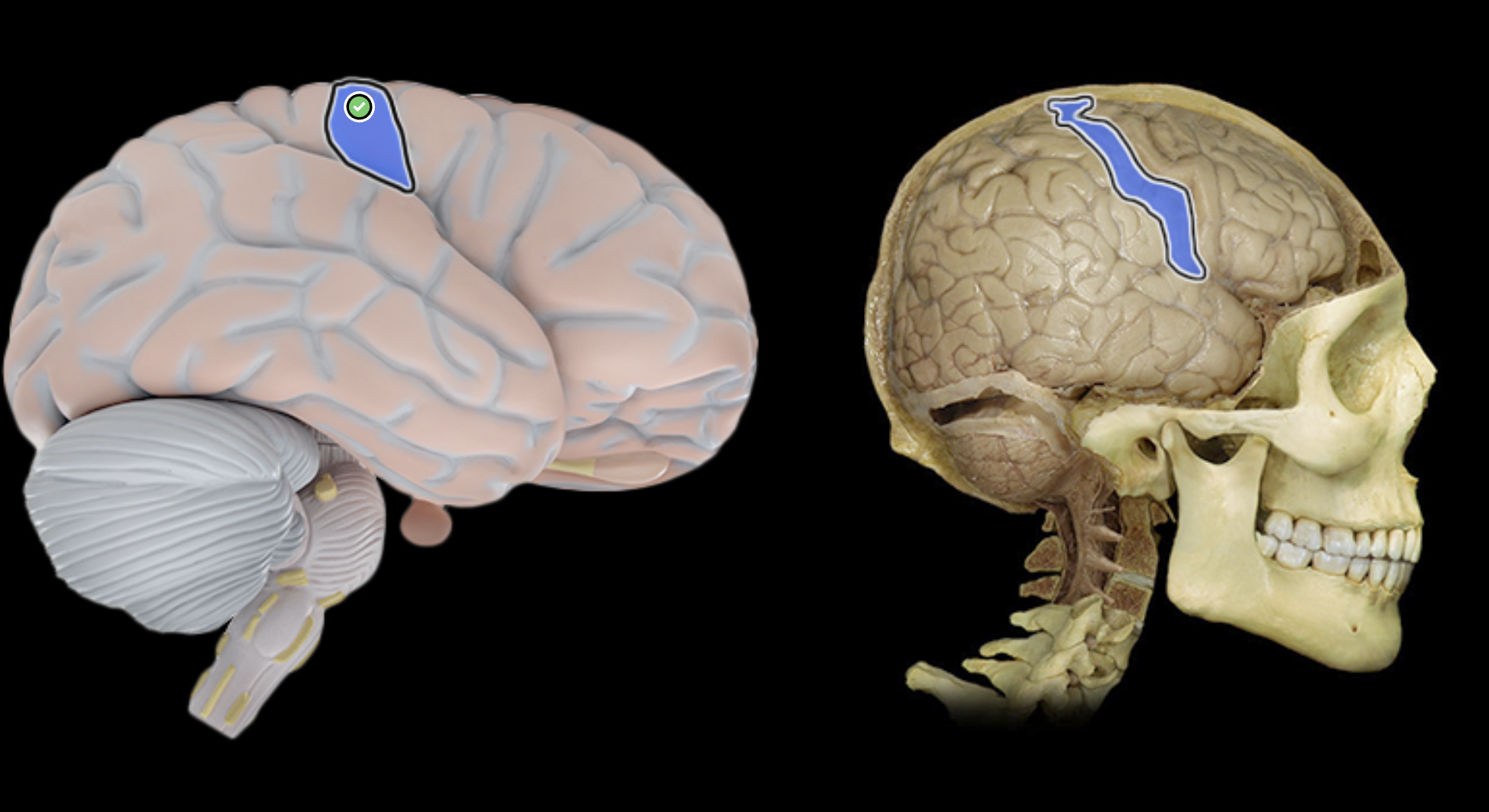 <p>What is labeled?</p>