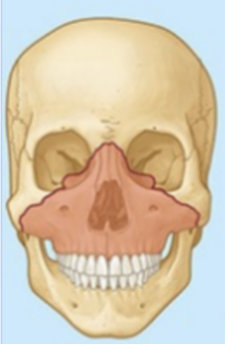 <p>What type of fracture?</p>