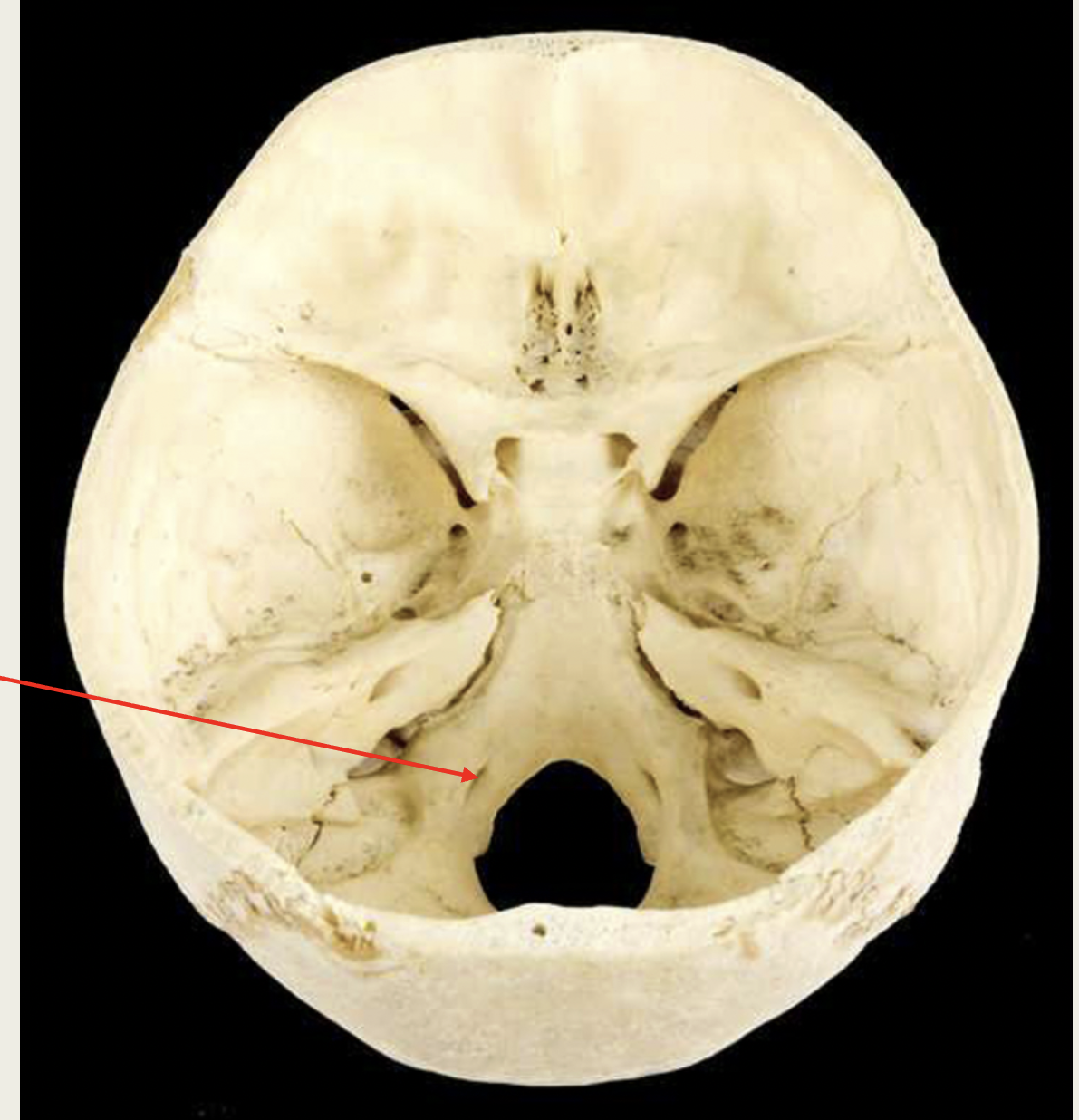 <p>Hypoglossal</p><p>Nerve (XII)</p><p>■ Function: XX XX (XX)</p><p>■ Passes through XX XX</p><p></p>
