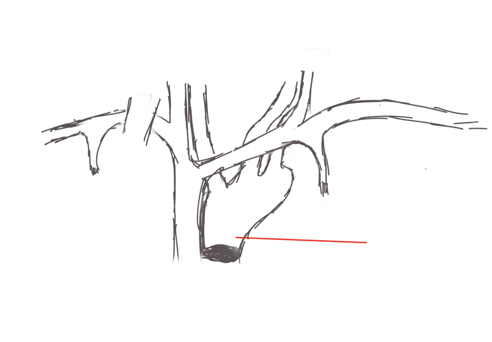 <p>portion. Top of the heart, below artery.</p>