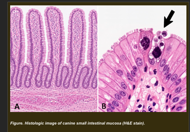 <p>A healthy adult dog dies of unrelated trauma. Routine post-mortem histologic sampling of the small intestinal mucosa shows the following at the villus tips:</p><p>- Individual epithelial cells demonstrating cell shrinkage</p><p>- Nuclear chromatin condensation into smooth crescent-shaped masses</p><p>- Membrane blebbing and formation of membrane-bound apoptotic bodies</p><p>- Apoptotic bodies being phagocytosed by neighboring epithelial cells and macrophages</p><p>- No inflammatory infiltrate in the surrounding mucosa</p><p>- The rest of the villus epithelium is intact and architecturally normal</p><p></p><p><strong>Which interpretation best explains the significance of the observed cellular changes at the villus tip?</strong></p><p><span>a. Pathologic apoptosis indicating early viral enteritis affecting the villus tip epithelium selectively</span></p><p><span>b. Physiologic apoptosis maintaining epithelial homeostasis through regulated removal of senescent cells at the villus tip, consistent with normal intestinal epithelial turnover</span></p><p><span>c. Necrosis at the villus tip caused by relative ischemia from the post-traumatic hemodynamic changes before death</span></p><p>d. Reversible cellular injury at the villus tip that will recover if the underlying cause is identified and treated</p>