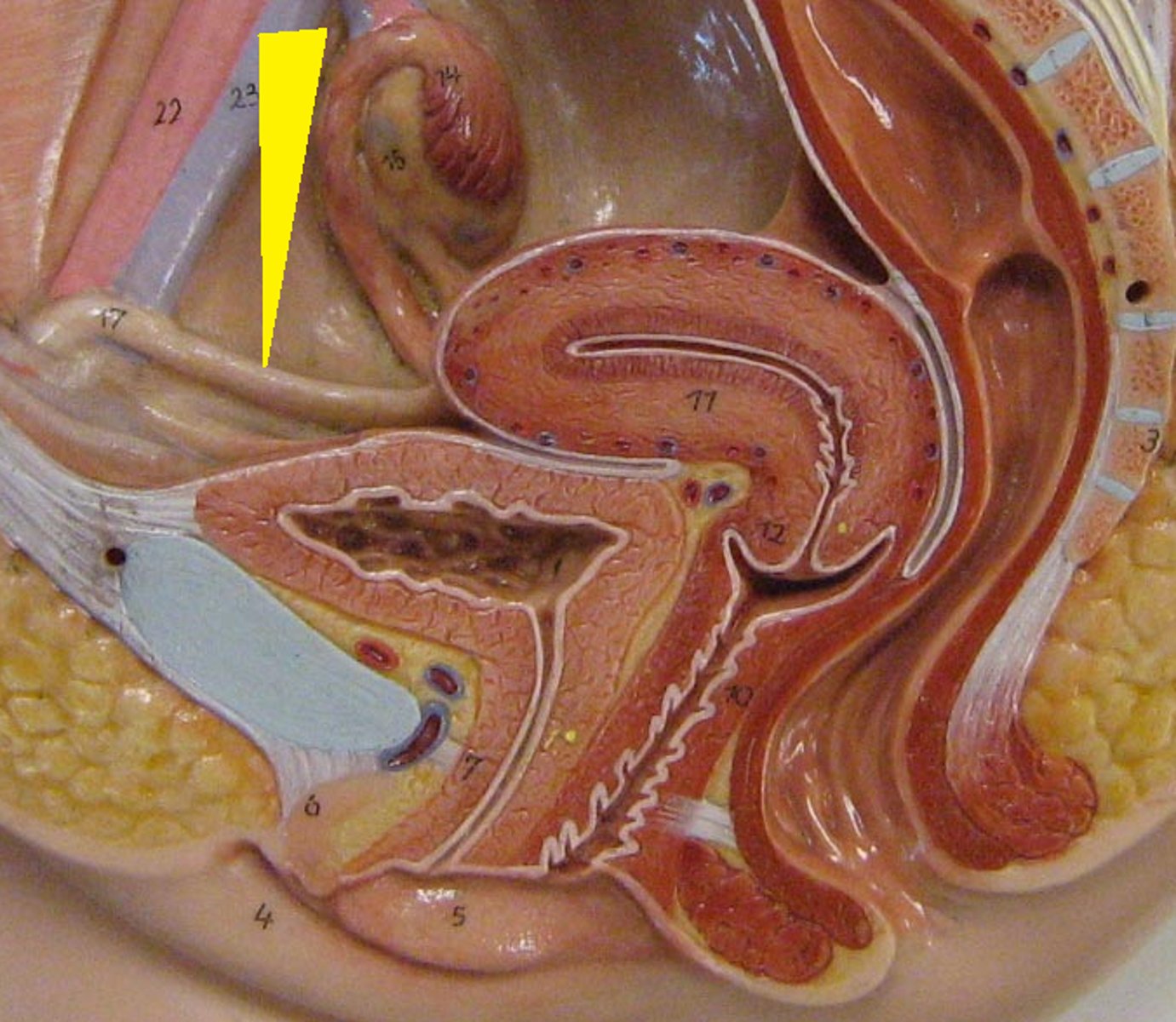 <p>l. in females that attaches to lateral walls of the uterus --> turns around and attaches to lateral walls of pelvis --> through superficial ring of inguinal canal --> attaches to pubic bone</p><p>function: anchors uterus</p>