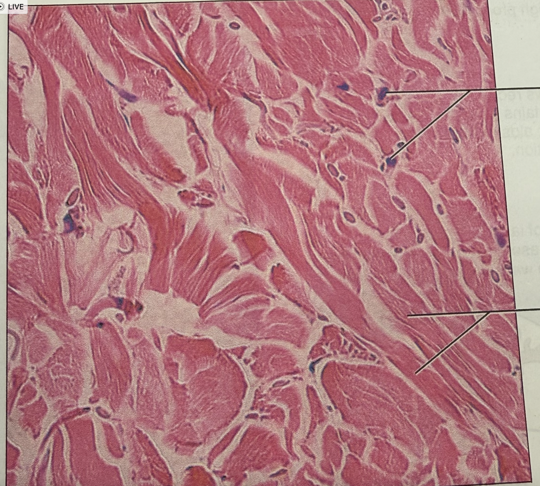 <p>where in the body is this tissue </p>
