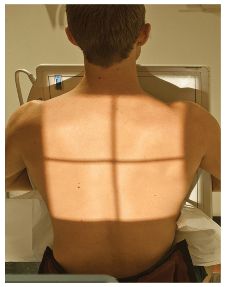<p>- What exam is this?</p><p>- What is this exam used for?</p><p>- What is the SID?</p><p>- Is the patient shielded?</p><p>- How is the patient positioned?</p><p>- What is the CR?</p><p>- What are the breathing instructions?</p><p>- What anatomy is demonstrated?</p>