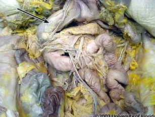 <p>what structure is pictured (be specfic; context: transverse colon and stomach have been reflected)?</p>