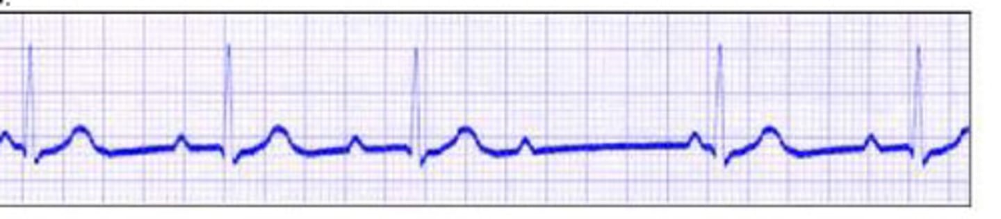 <p>what is this</p>