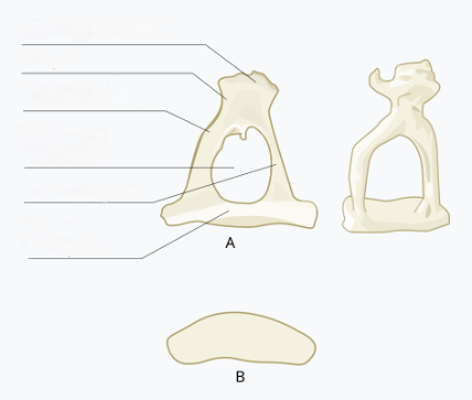Label the parts of the Stapes