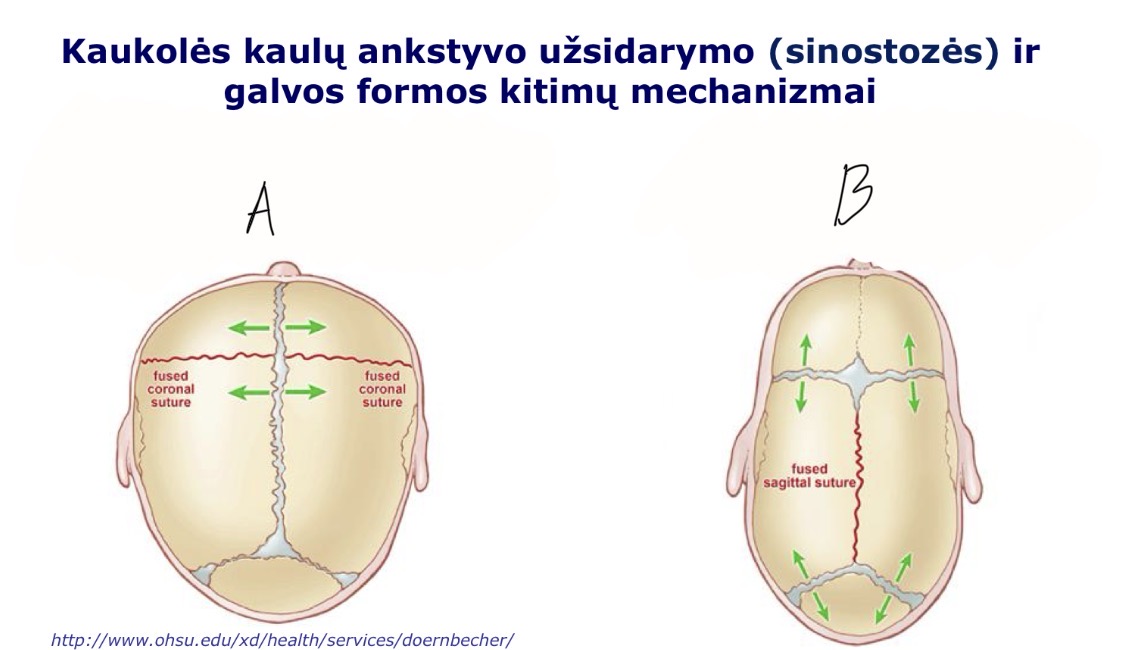 <p>B</p>