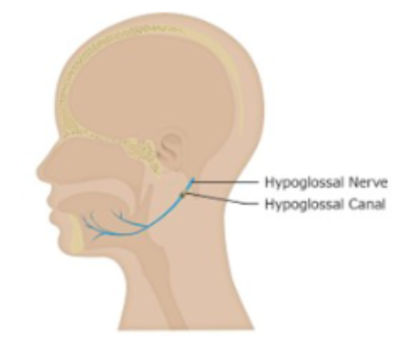 <ul><li><p>XII</p></li><li><p>efferent </p></li><li><p>Innervates all intrinsic and most extrinsic muscles of the tongue</p></li></ul><p>• Intrinsic muscles (body of tongue) used for fine motor movements of articulation</p><p>• Extrinsic muscles used for gross motor movements for mastication and swallowing</p><p>• Innervates some muscles of the neck</p><p></p>