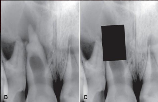 <p>what is this, and what does it result from?</p>