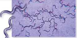 <p>Spirillum - rigid </p><p>Spirochete - flexible</p>