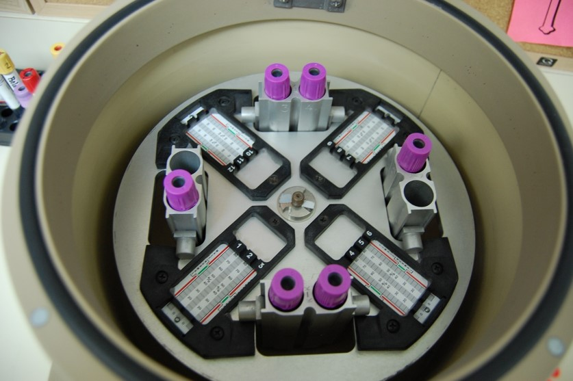 <p>T/F: This centrifuge is balanced correctly</p>